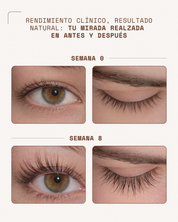 KosmaLash Sérum | Crecimiento & Anticaída