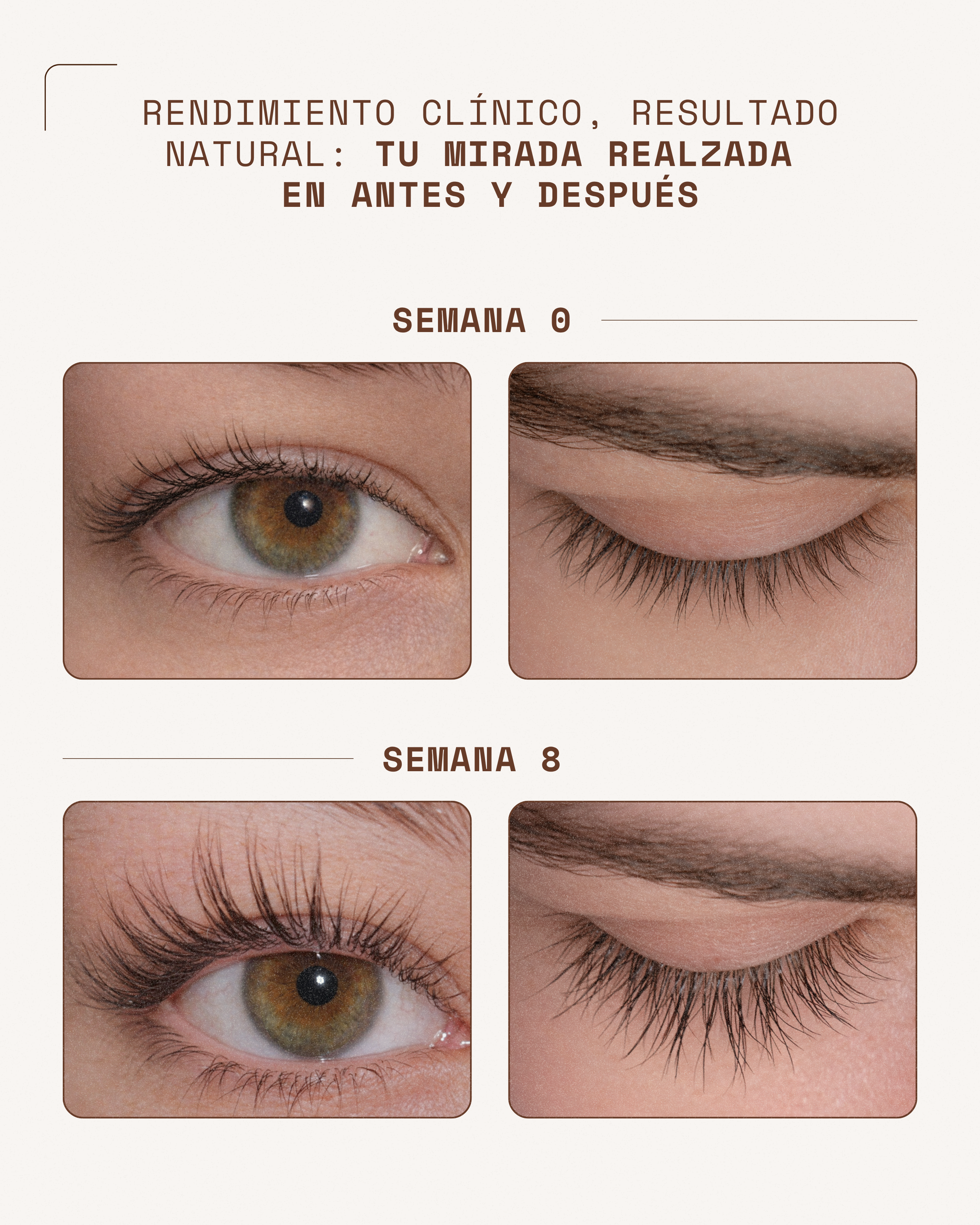 KosmaLash Sérum | Crecimiento & Anticaída