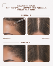 KosmaHair Sérum | Restaurador Capilar & Entradas