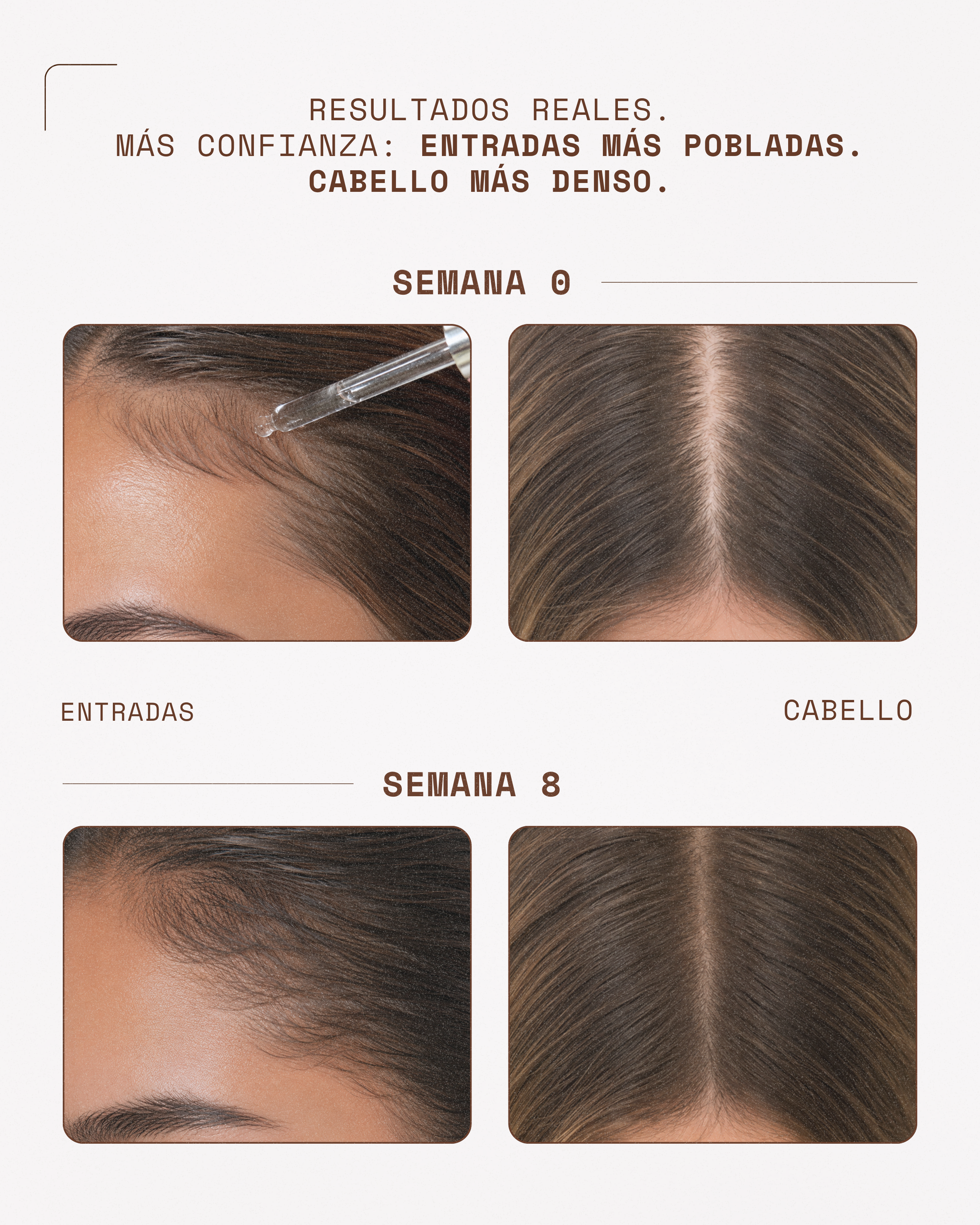 KosmaHair Sérum | Restaurador Capilar & Entradas