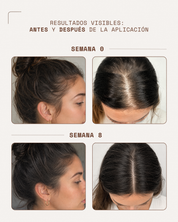 KosmaHair Sérum | Restaurador Capilar & Entradas
