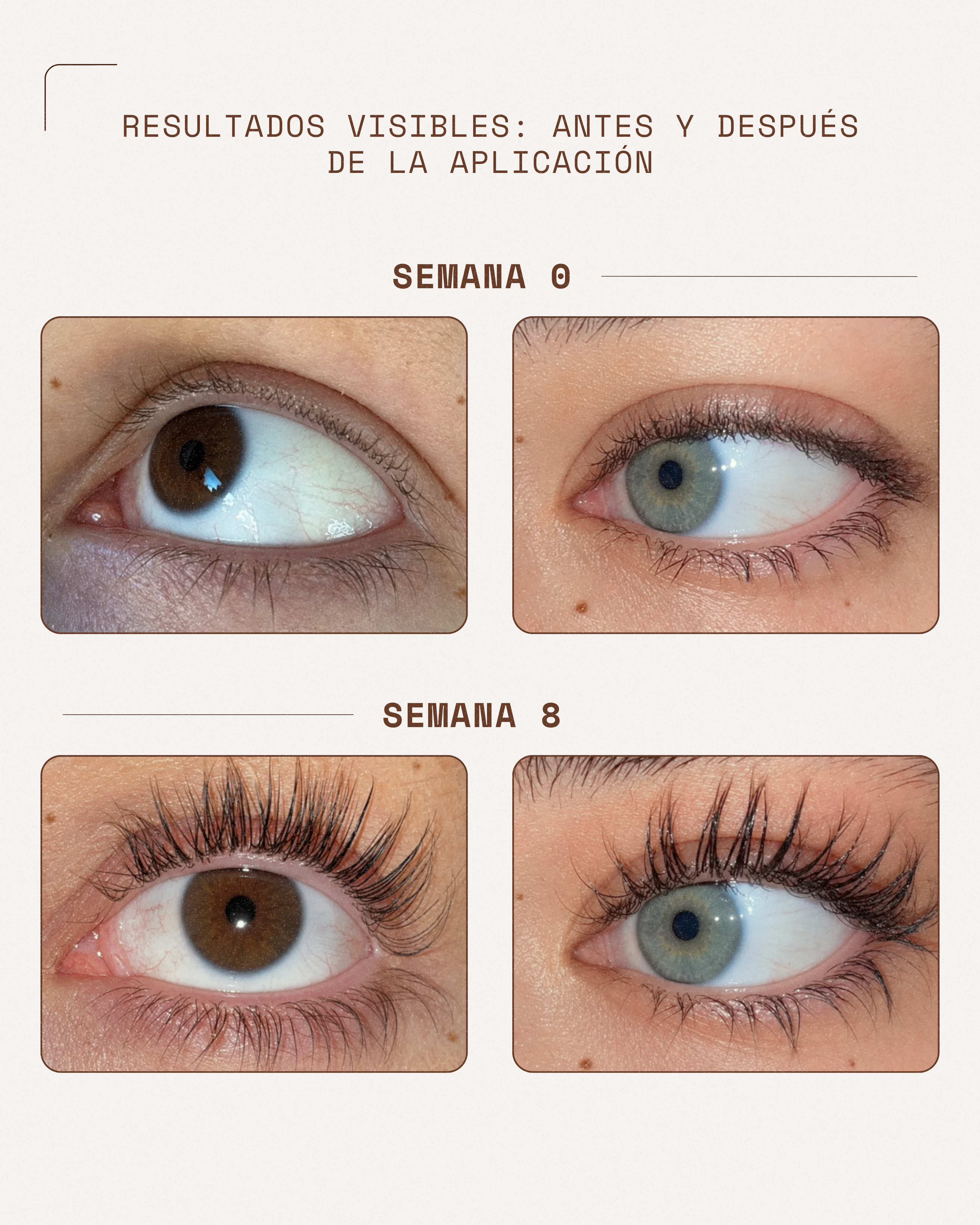 KosmaLash Sérum | Crecimiento & Anticaída
