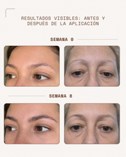 KosmaBrow Sérum | Crecimiento & Engrosamiento