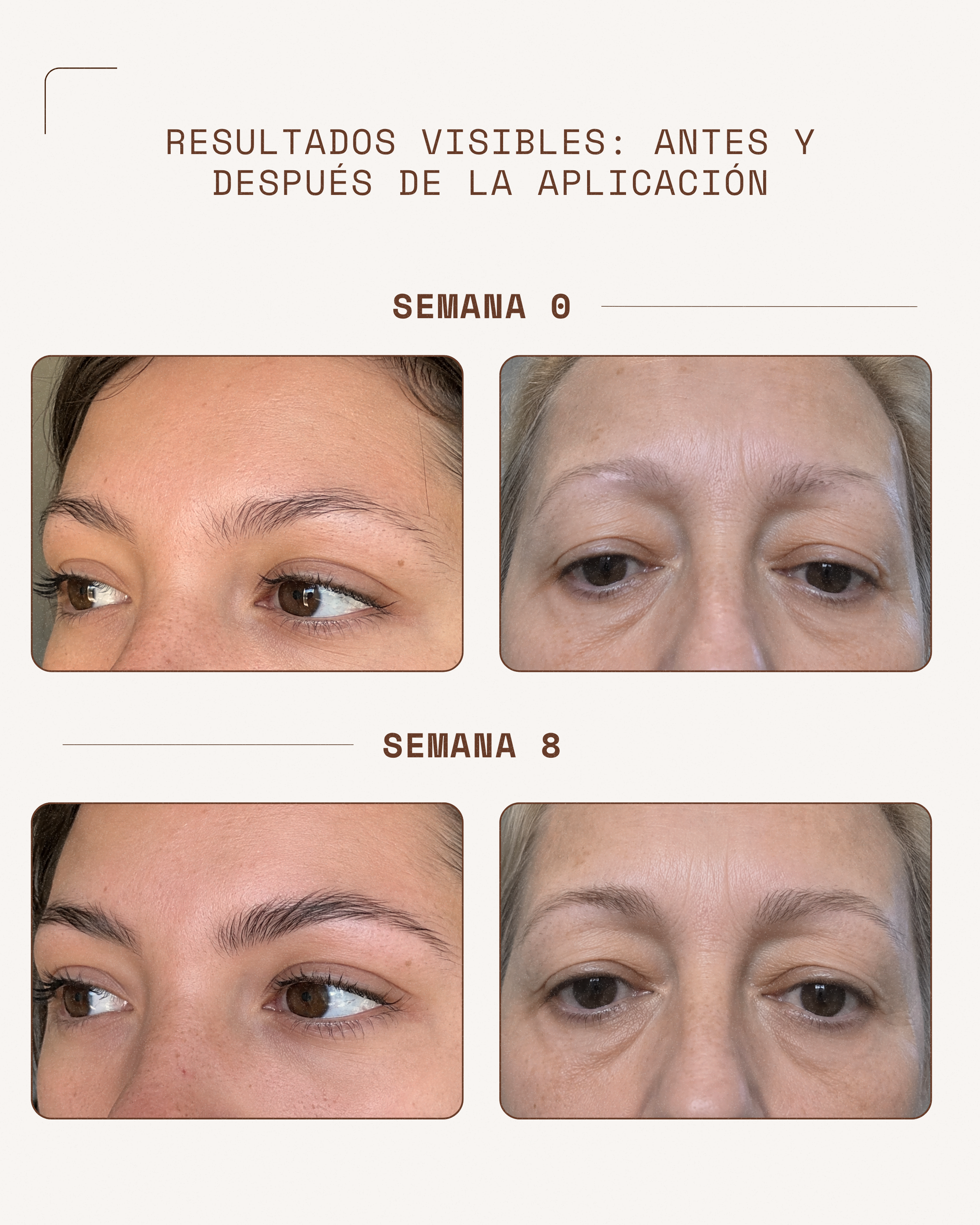 KosmaBrow Sérum | Crecimiento & Engrosamiento